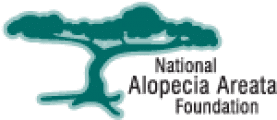 National alopecia