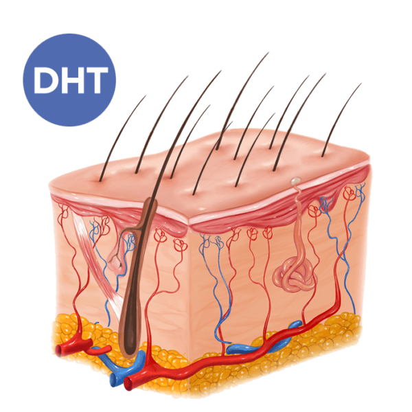 Treatment Solutions for Men in Houston, TX TM Hair