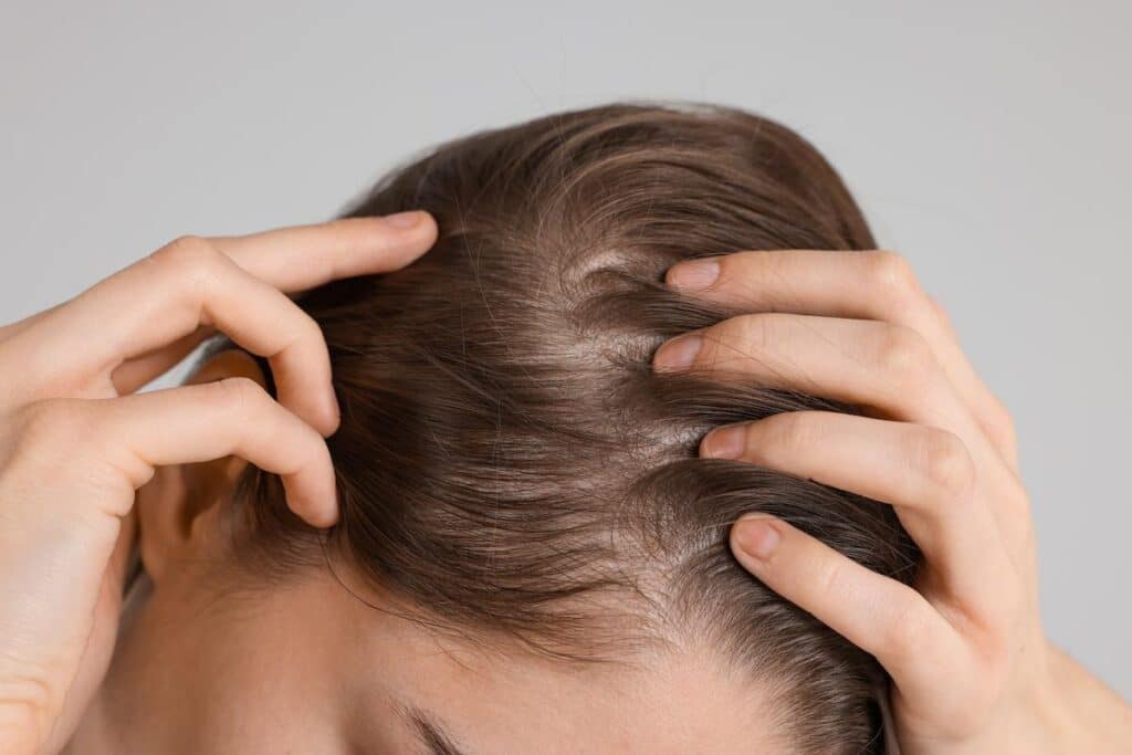 Girl with hair loss problem on grey background, closeup